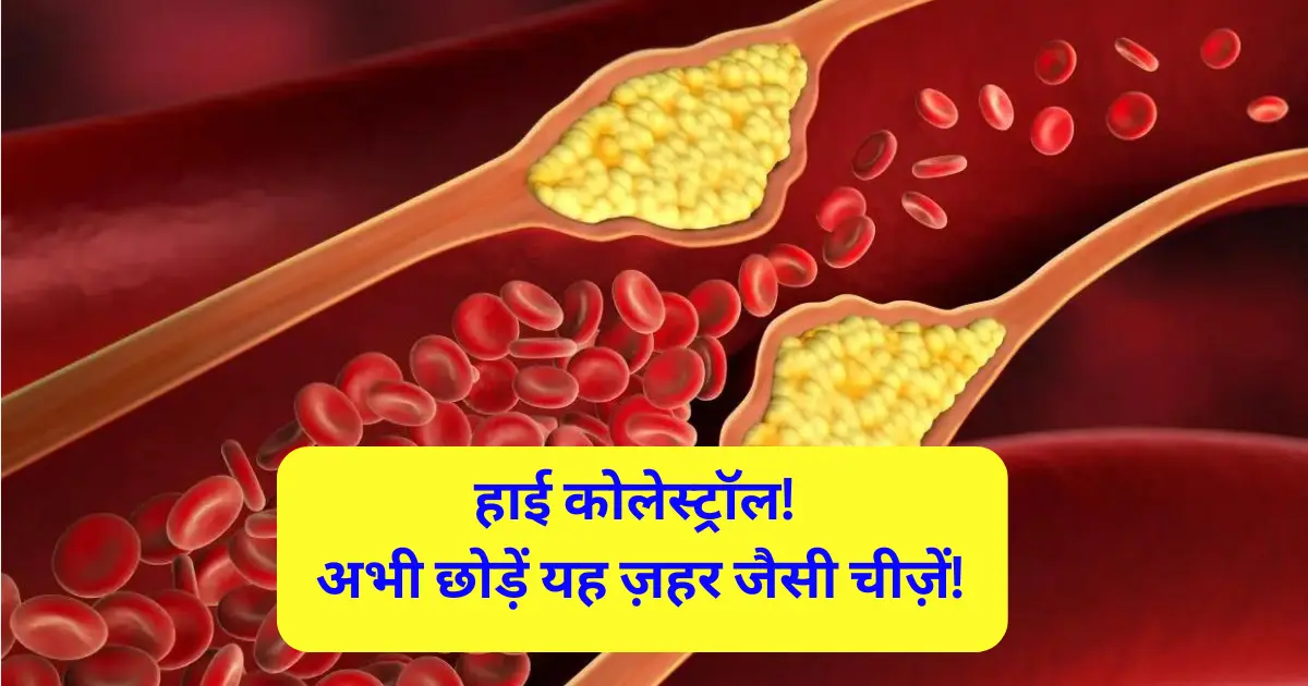 High Cholesterol में ज़हर जैसी है यह चीज़ें अभी छोड़ें!